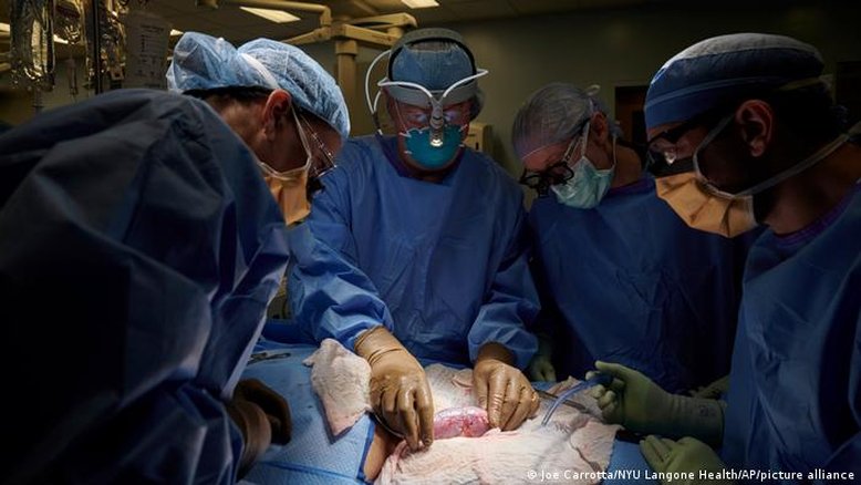 Pela primeira vez, rim suíno é transplantado com sucesso em humano