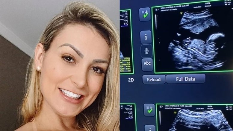 Montagem reprodução Instagram