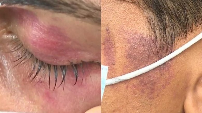 Casal homossexual diz que foi agredido por policial militar em Goiás