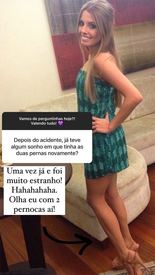 Paola Antonini mostra foto antiga com as duas pernas 4 Paola Antonini mostra foto antiga com as duas pernas