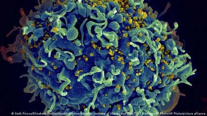 Paciente teria se curado do HIV com imunidade natural