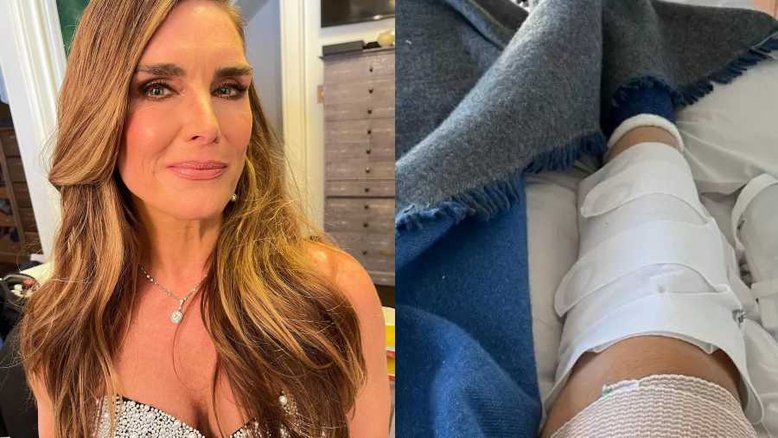 Brooke Shields dispensou analgésico após quebrar fêmur para 'sentir a dor'