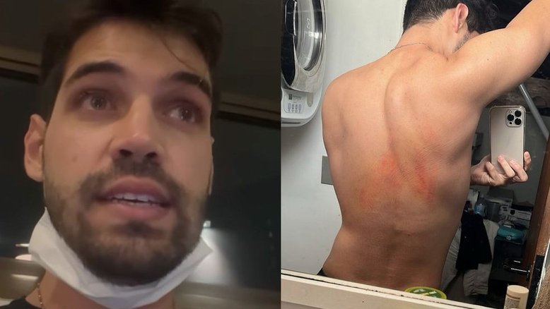 Influenciador diz que foi vítima de homofobia: 'Carro quase passou por cima'