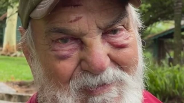 Aos 92 anos, Lima Duarte se envolveu em acidente de trânsito; o veterano ainda pode dirigir ?