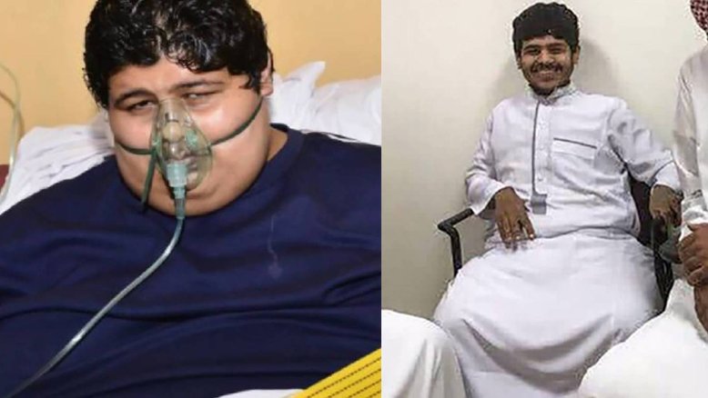 Divulgação/ Ministério da Saúde da Arábia Saudita