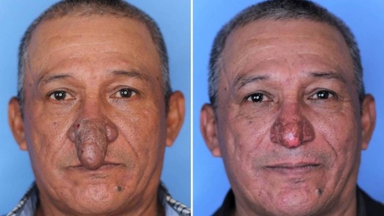 Divulgação/ Dr. Thomas Romo 