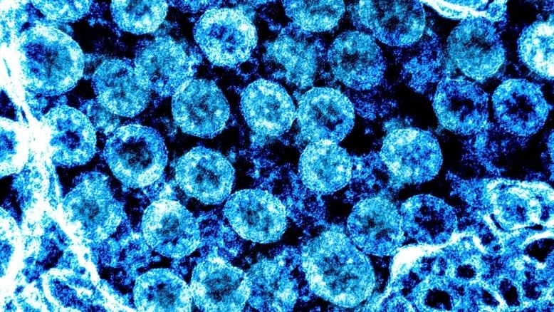 Mais contagiosa, mas menos grave: o perfil da ômicron vai ganhando corpo