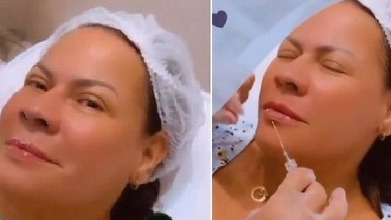 Mãe de Marília Mendonça faz botox pra receber premio no lugar da cantora