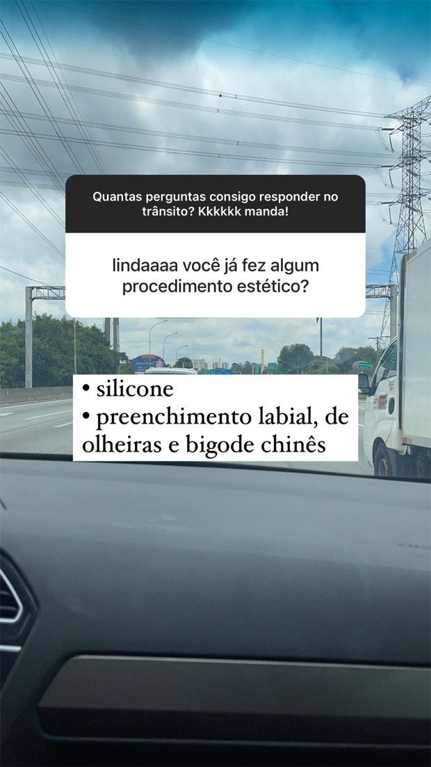 Maria Lina conta aos seguidores quais procedimentos estéticos já fez 4 Maria Lina conta aos seguidores quais procedimentos estéticos já fez