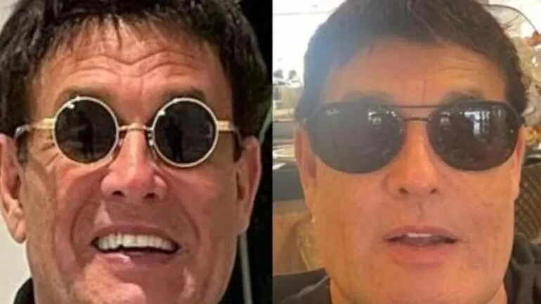 Sérgio Mallandro faz harmonização facial e comemora: 