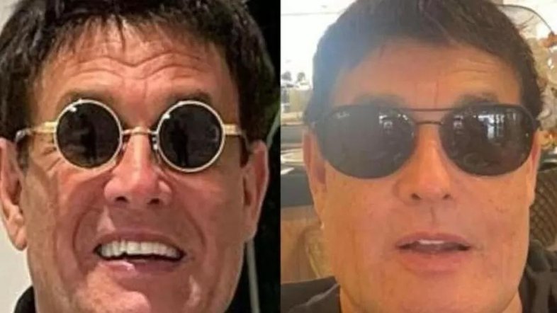 Sérgio Mallandro faz harmonização facial e comemora: 'Novinho'