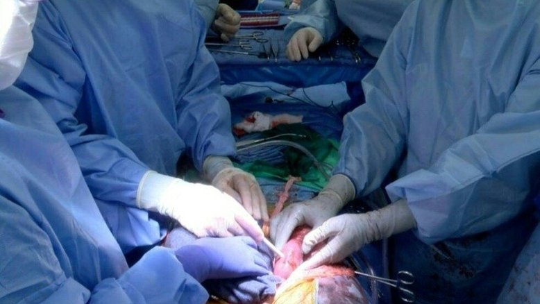 Foto fornecida pela Universidade do Alabama de transplante de 30 de setembro de 2021 - Université d'Alabama/AFP