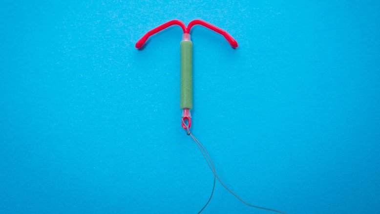 é normal ter menstruações irregulares usando diu?