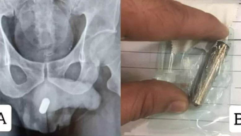Reprodução/Science Direct