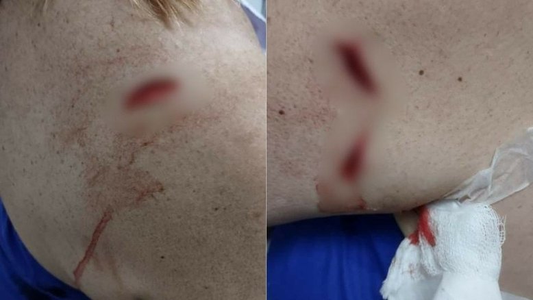 Reprodução/Facebook