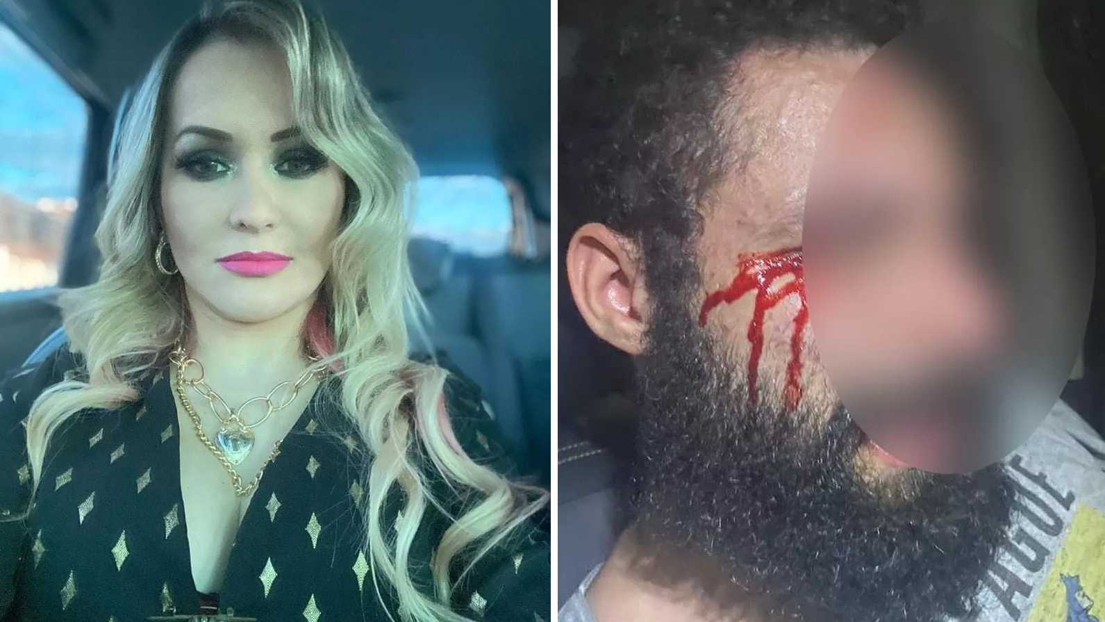 Médica condenada por mandar cortar pênis do ex é investigada por torturar marido