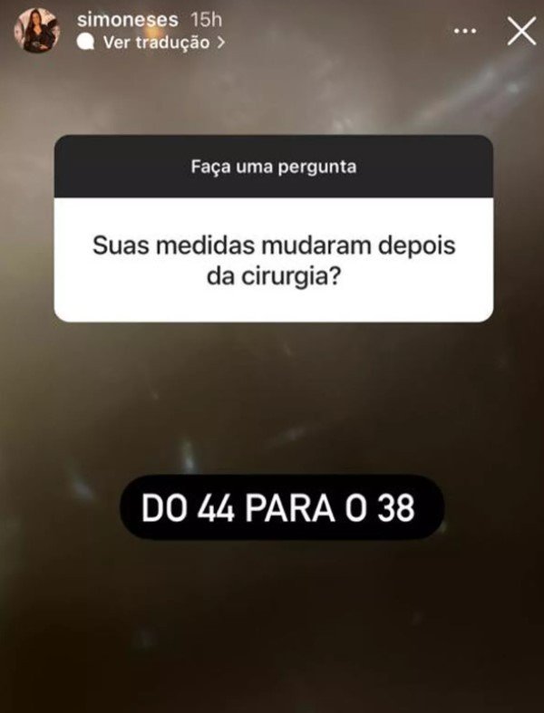 Simone perde seis números de medida no manequim após dietas e cirurgia 4 Simone perde seis números de medida no manequim após dietas e cirurgia