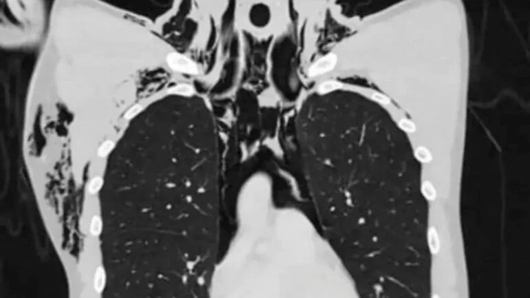 Reprodução/Radiology Case Reports