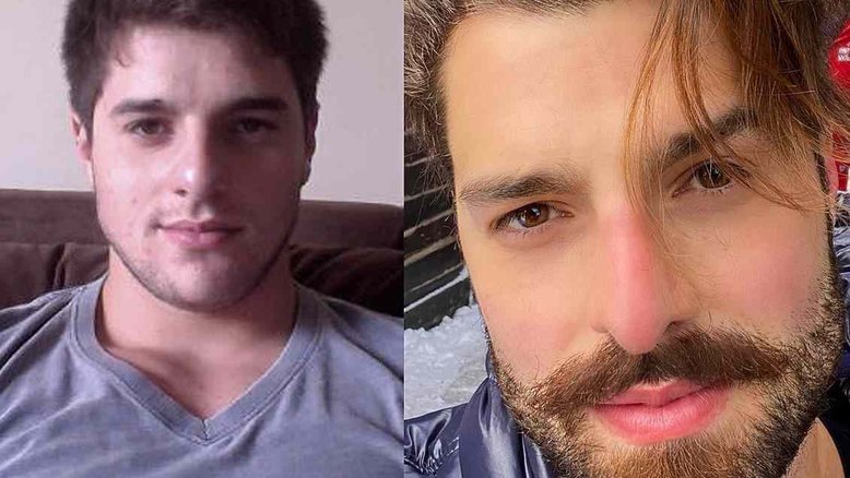 Alok faz ‘desafio dos 10 anos’ e choca web com mudança: ‘Teve procedimento aí’