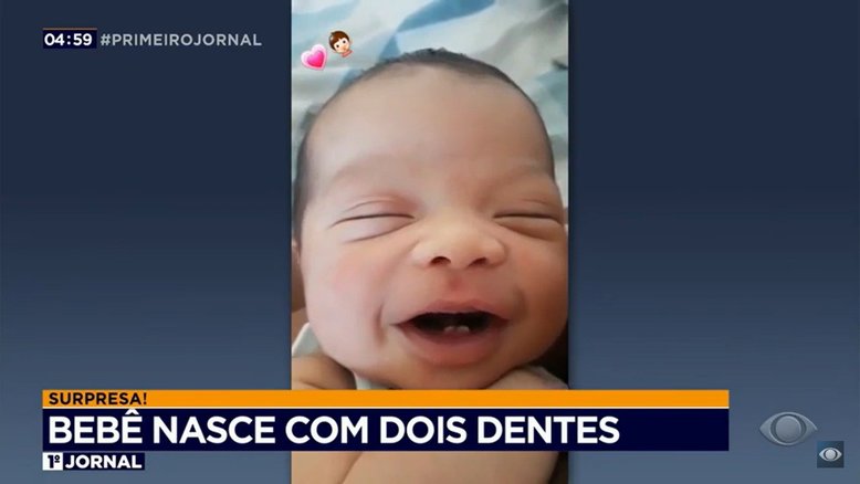 Reprodução