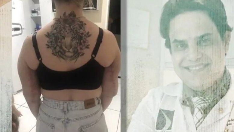 Reprodução