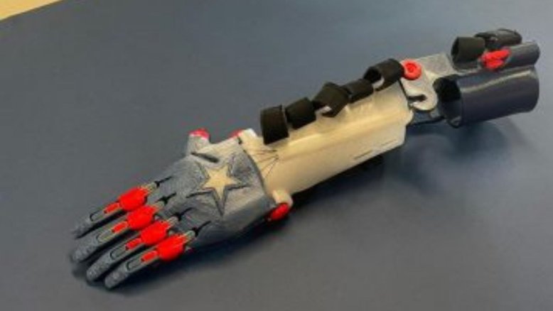 Criança com deficiência ganha prótese em 3D com estampa do Capitão América