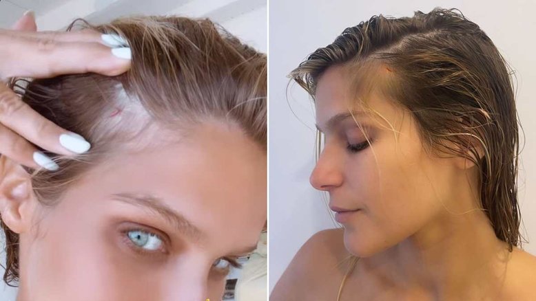 Isabella Santoni corta a cabeça após acidente de surfe e cogita raspar cabelo
