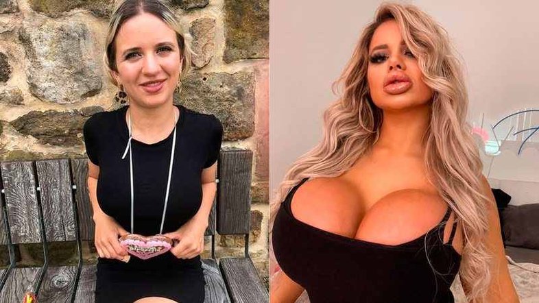 Jessy Bunny investiu R$ 315 mil em plásticas nos últimos dois anos