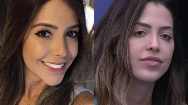 Antes e depois de Laís repercute e ela rebate críticas: 'Botox e preenchimento'