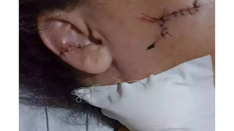 Motorista de app é esfaqueada por passageiro e pede ajuda: "Tô morrendo"