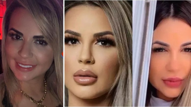 deolane antes e depois
