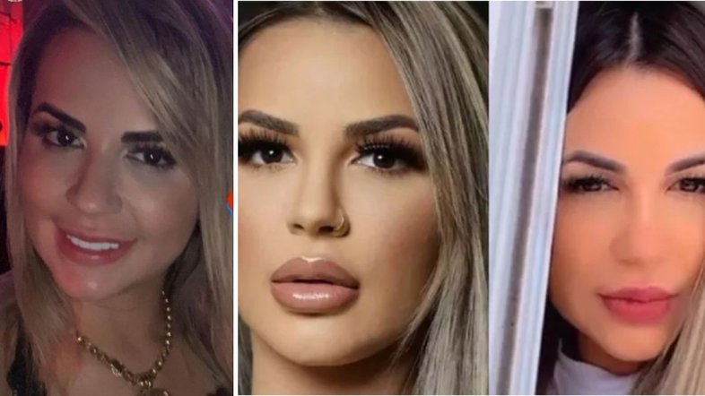 deolane antes e depois