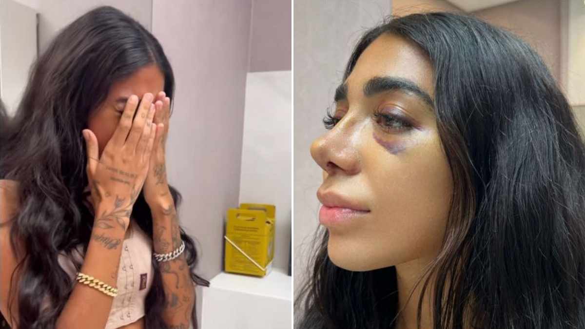 Dhiovanna Barbosa, irmã de Gabigol, chora ao ver nariz após plástica