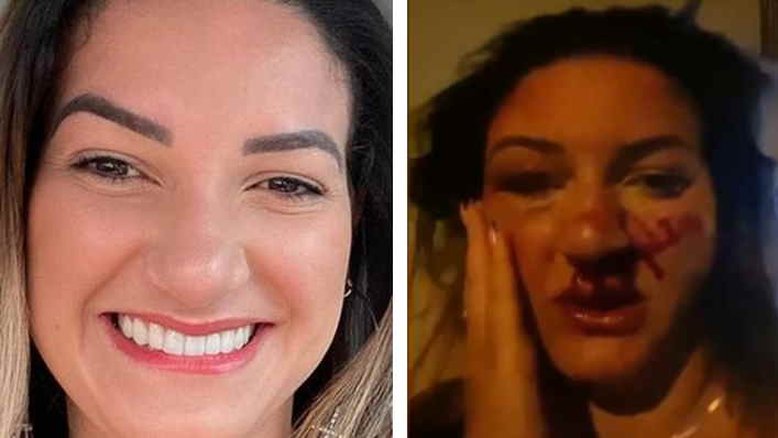 RJ: Mulher é espancada por ex-marido que não aceitou o término da relação