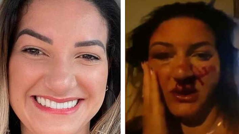 RJ: Mulher é espancada por ex-marido que não aceitou o término da relação