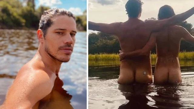 José Loreto posa nu e deixa à mostra dispositivo para diabetes no bumbum