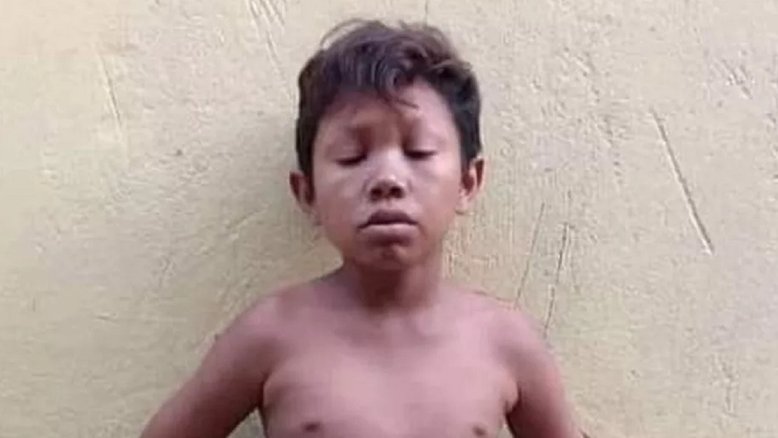 Reprodução