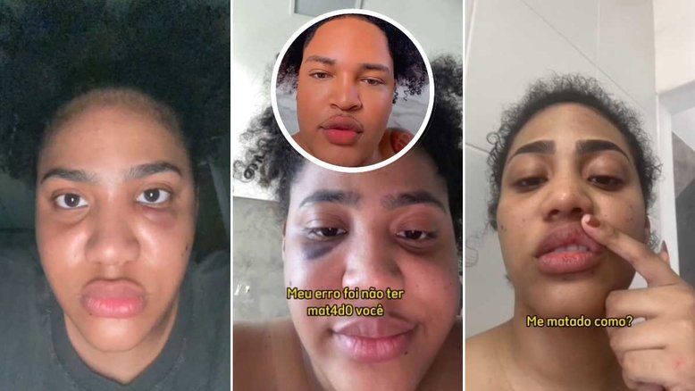 Influencer Kelly Pereira denuncia humorista Lucas AK por agressões