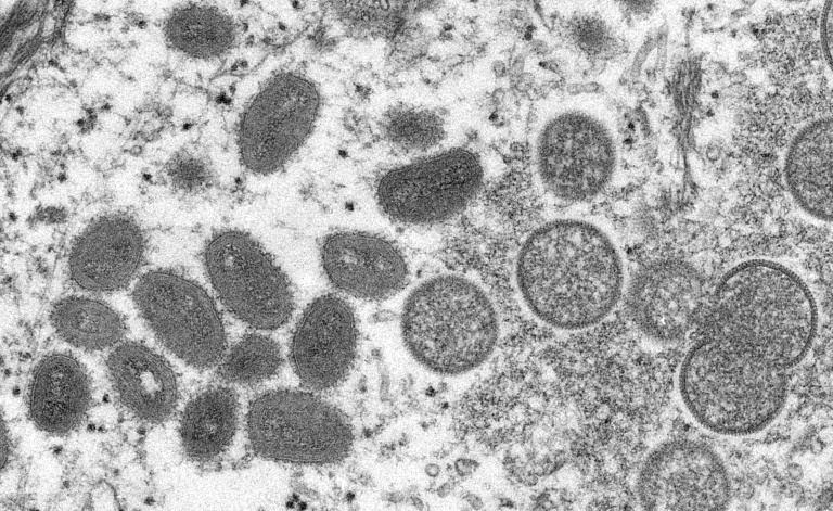 Imagem de microscópio mostra estrutura do vírus da varíola dos macacos - Centers for Disease Control and Prevention/AFP/Arquivos