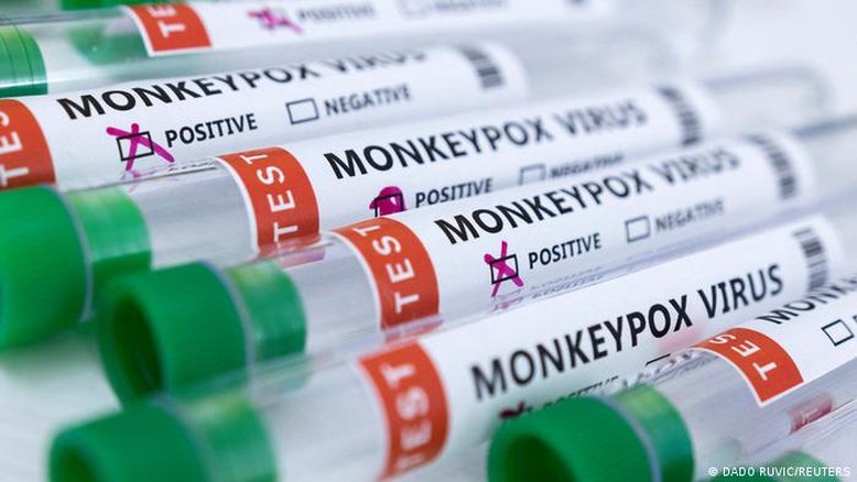 OMS descarta emergência global devido à varíola dos macacos