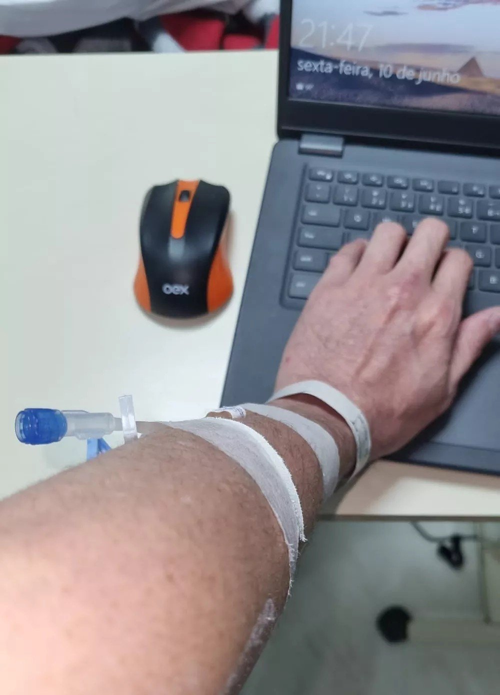 Varíola dos Macacos: 1º brasileiro diagnosticado está isolado: 'Já contei 60 feridas, mas estou ótimo'