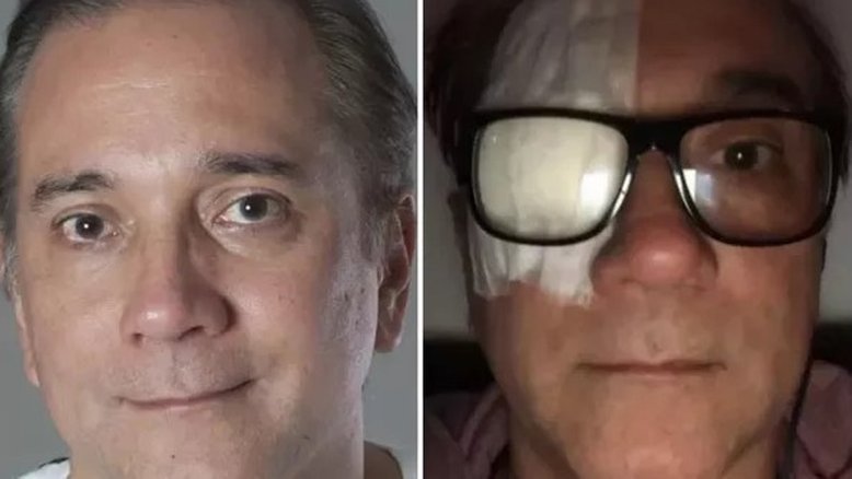 Vocalista do Biquíni Cavadão retira tumor do olho: 'Identificamos cedo'