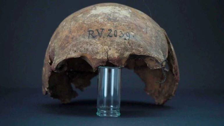 Ossos do crânio do homem enterrado em Rinnukalns, Letônia, há cerca de 5 mil anos: vestígios de Yersinia pestis. Crédito: Dominik Göldner, BGAEU, Berlim