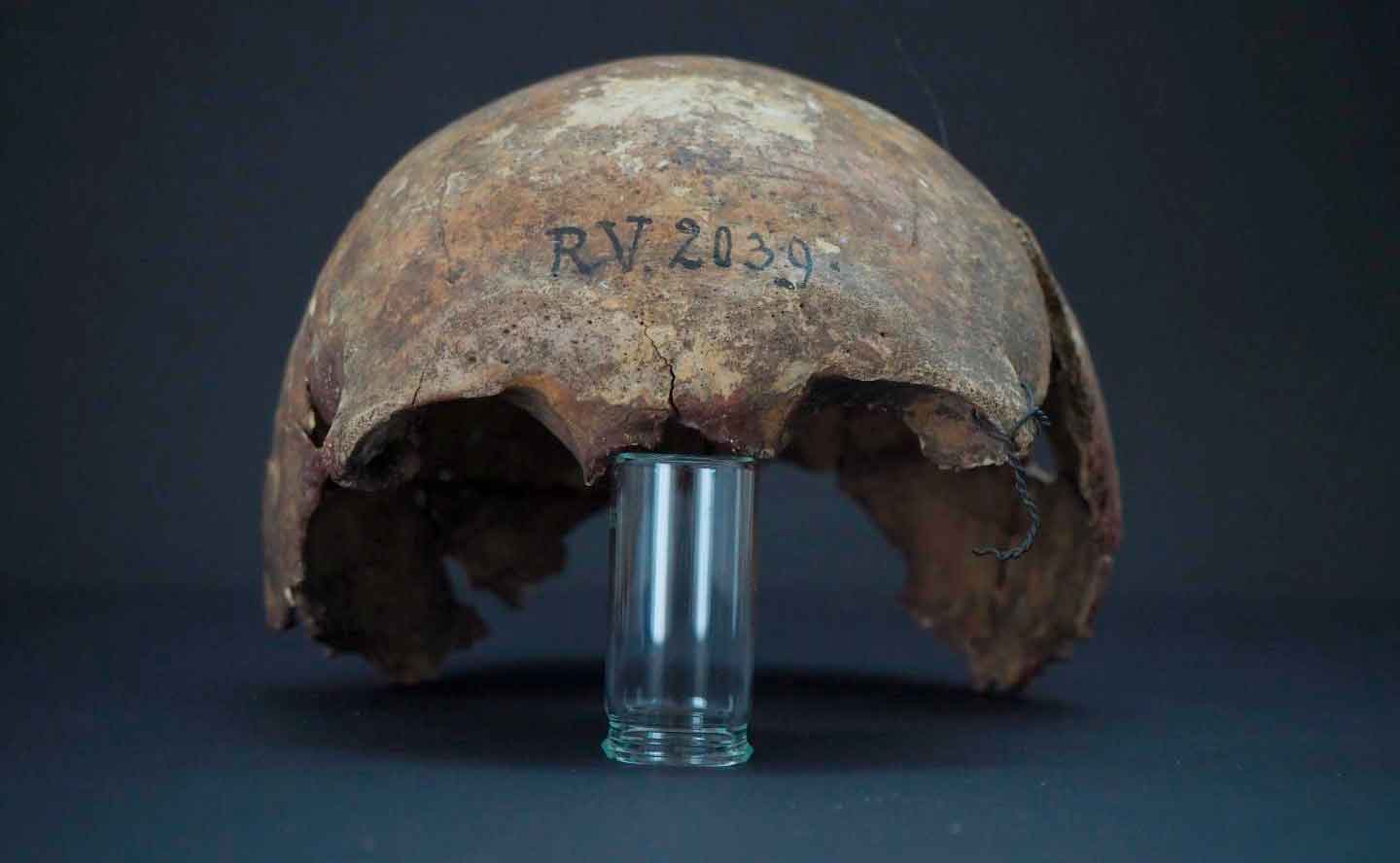Ossos do crânio do homem enterrado em Rinnukalns, Letônia, há cerca de 5 mil anos: vestígios de Yersinia pestis. Crédito: Dominik Göldner, BGAEU, Berlim
