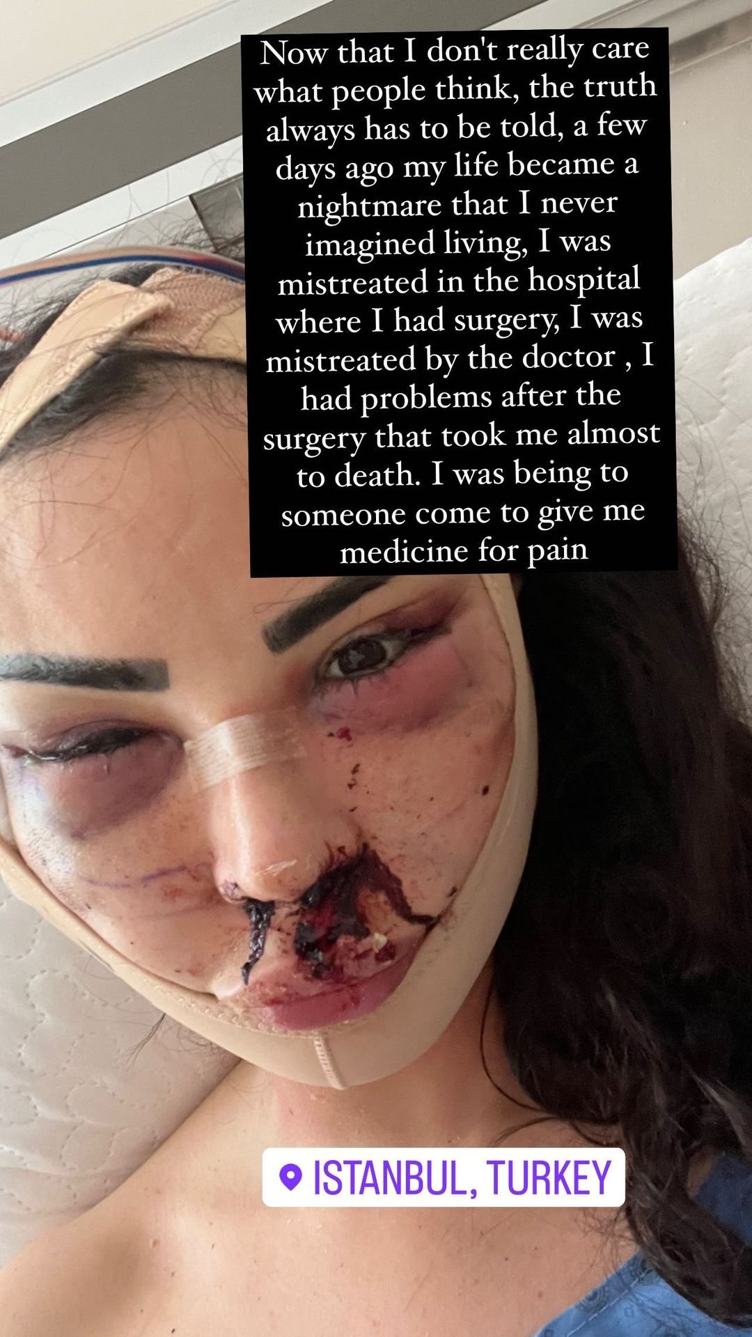 Modelo brasileira denuncia violência cirúrgica na Turquia; imagens fortes