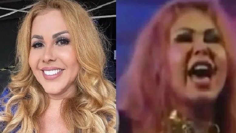 Dermatologistas explicam 'rosto deformado' de Joelma após sequela da Covid-19