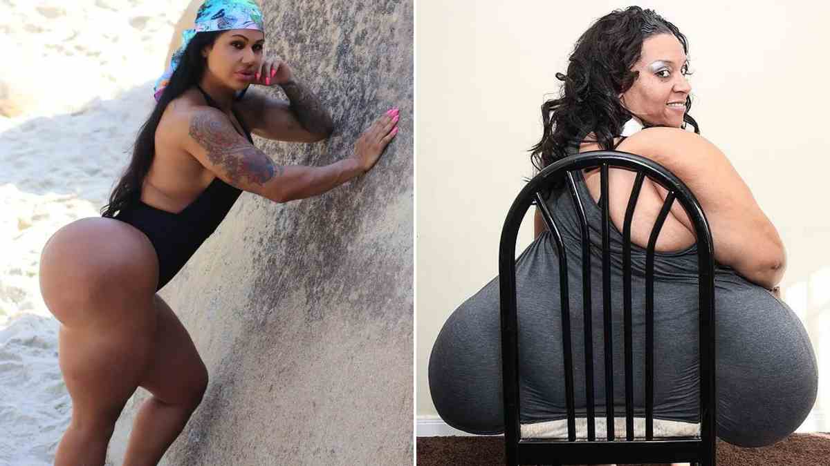 Dona do maior bumbum do Brasil quer superar recordista mundial com 250 cm