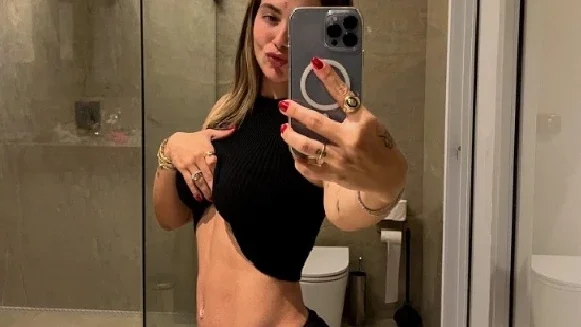 Cirurgião explica motivo da barriga de grávida de Virginia 