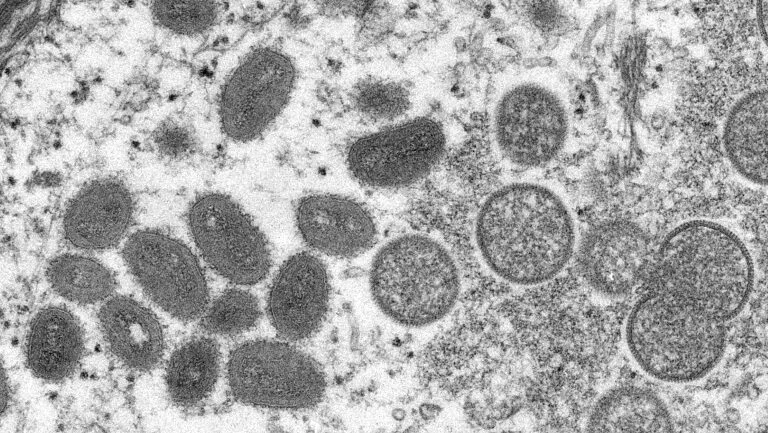 Varíola dos macacos: SP tem 2 grávidas e 5 crianças infectadas