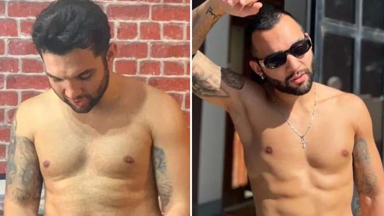 Jonathan Costa diz que perdeu 25 kg depois de ter desenvolvido compulsão alimentar